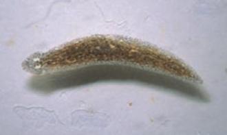 e. Phylum Turbellaria ( flatworms)